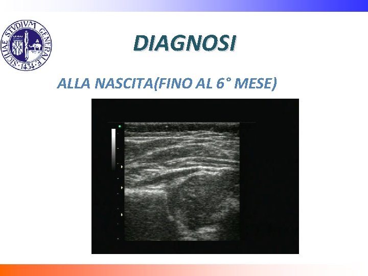 DIAGNOSI ALLA NASCITA(FINO AL 6° MESE) 