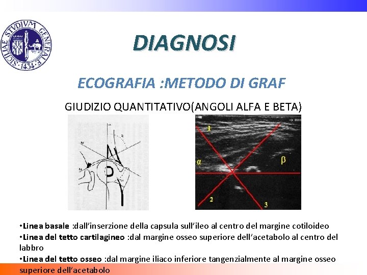 DIAGNOSI ECOGRAFIA : METODO DI GRAF GIUDIZIO QUANTITATIVO(ANGOLI ALFA E BETA) • Linea basale