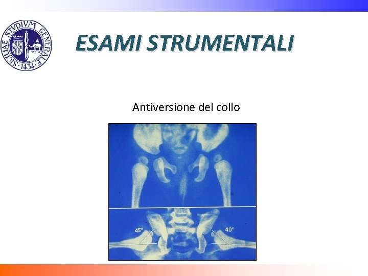 ESAMI STRUMENTALI Antiversione del collo 