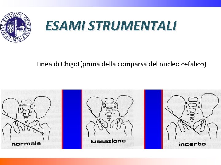 ESAMI STRUMENTALI Linea di Chigot(prima della comparsa del nucleo cefalico) 