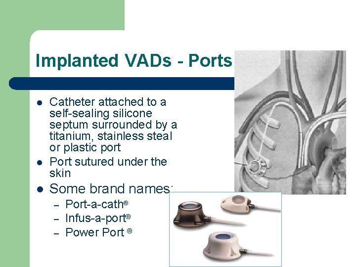 Implanted VADs - Ports l l l Catheter attached to a self-sealing silicone septum
