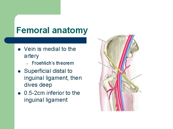 Femoral anatomy l Vein is medial to the artery – l l Froehlich’s theorem