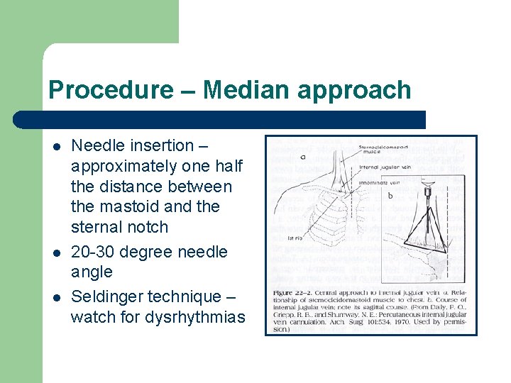 Procedure – Median approach l l l Needle insertion – approximately one half the