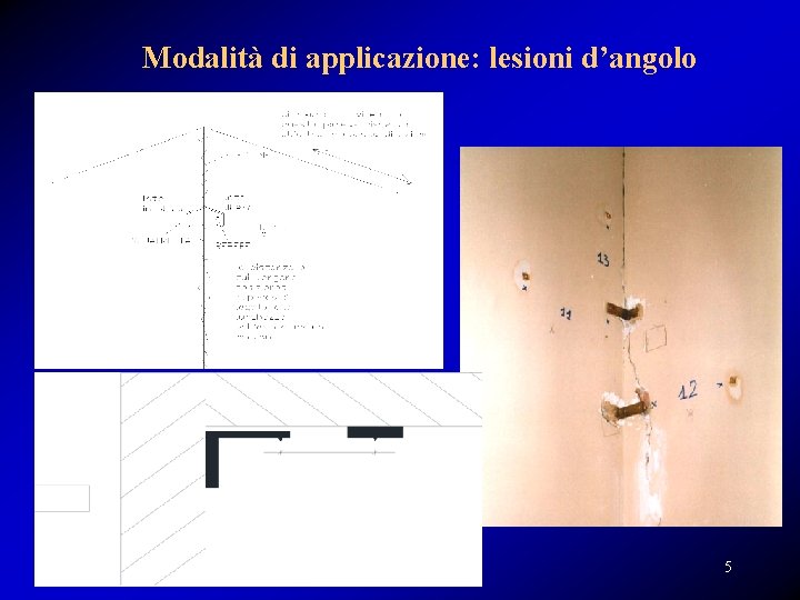 Modalità di applicazione: lesioni d’angolo 5 