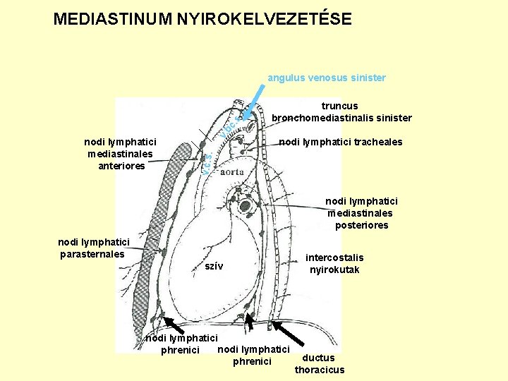 MEDIASTINUM NYIROKELVEZETÉSE truncus bronchomediastinalis sinister nodi lymphatici tracheales v. c. s. nodi lymphatici mediastinales