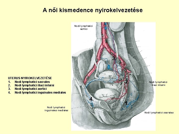 A női kismedence nyirokelvezetése Nodi lymphatici aortici 3. UTERUS NYIROKELVEZETÉSE 1. Nodi lymphatici sacrales