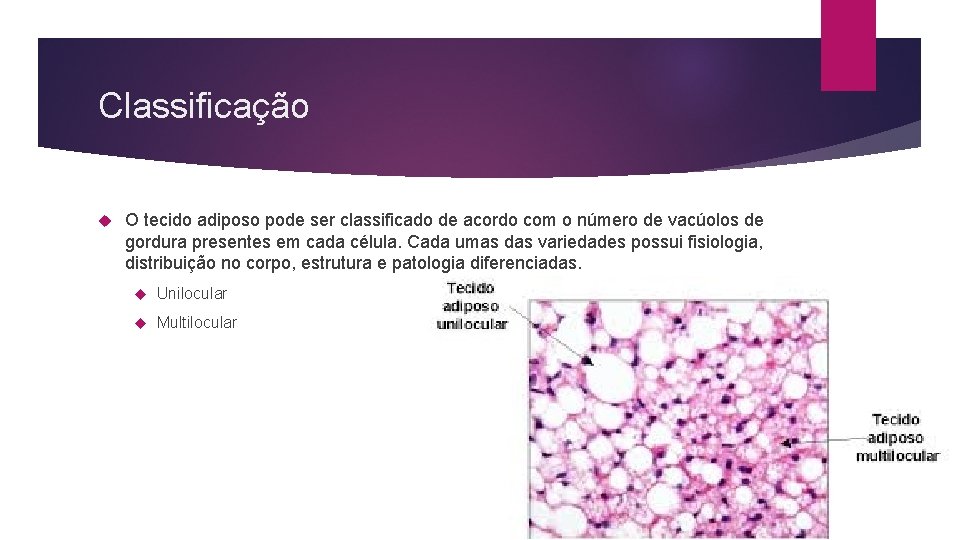 Classificação O tecido adiposo pode ser classificado de acordo com o número de vacúolos