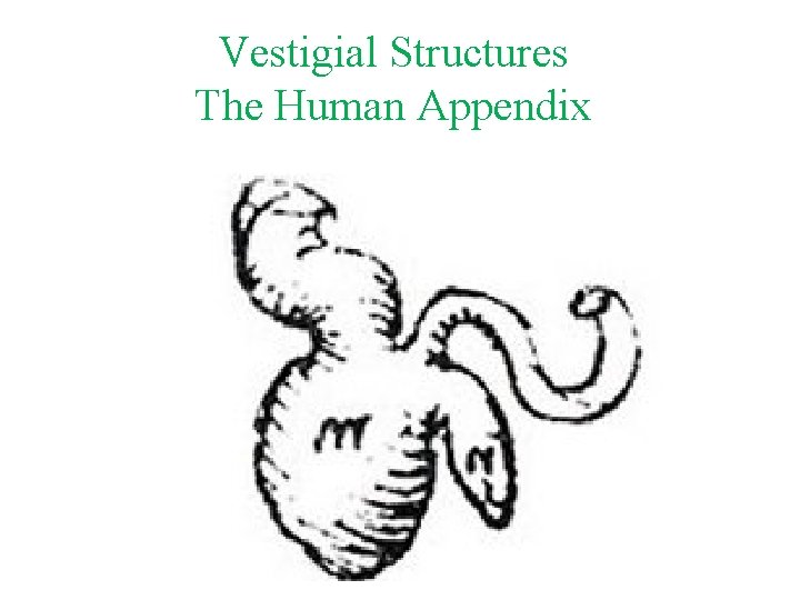 Vestigial Structures The Human Appendix 