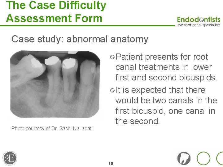 The Case Difficulty Assessment Form Case study: abnormal anatomy Patient presents for root canal