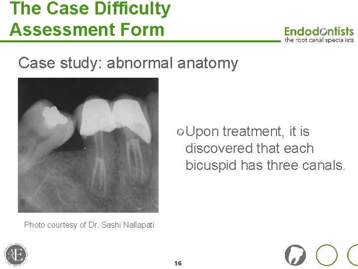 The Case Difficulty Assessment Form Case study: abnormal anatomy Upon treatment, it is discovered