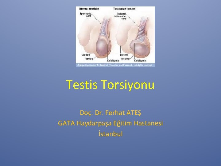 Testis Torsiyonu Doç. Dr. Ferhat ATEŞ GATA Haydarpaşa Eğitim Hastanesi İstanbul Testis Torsiyonu Doç. Dr. Ferhat ATEŞ GATA Haydarpaşa Eğitim Hastanesi İstanbul