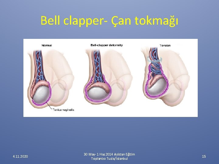 Bell clapper- Çan tokmağı 4. 11. 2020 30 May- 1 Haz 2014 Asistan Eğitim Bell clapper- Çan tokmağı 4. 11. 2020 30 May- 1 Haz 2014 Asistan Eğitim