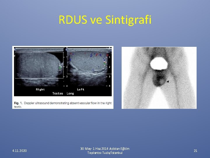 RDUS ve Sintigrafi 4. 11. 2020 30 May- 1 Haz 2014 Asistan Eğitim Toplantısı RDUS ve Sintigrafi 4. 11. 2020 30 May- 1 Haz 2014 Asistan Eğitim Toplantısı