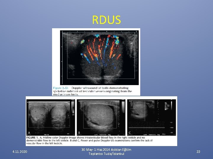 RDUS 4. 11. 2020 30 May- 1 Haz 2014 Asistan Eğitim Toplantısı Tuzla/İstanbul 22 RDUS 4. 11. 2020 30 May- 1 Haz 2014 Asistan Eğitim Toplantısı Tuzla/İstanbul 22