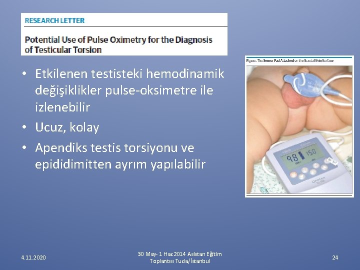 • Etkilenen testisteki hemodinamik değişiklikler pulse-oksimetre ile izlenebilir • Ucuz, kolay • Apendiks • Etkilenen testisteki hemodinamik değişiklikler pulse-oksimetre ile izlenebilir • Ucuz, kolay • Apendiks