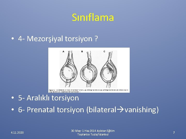 Sınıflama • 4 - Mezorşiyal torsiyon ? • 5 - Aralıklı torsiyon • 6 Sınıflama • 4 - Mezorşiyal torsiyon ? • 5 - Aralıklı torsiyon • 6