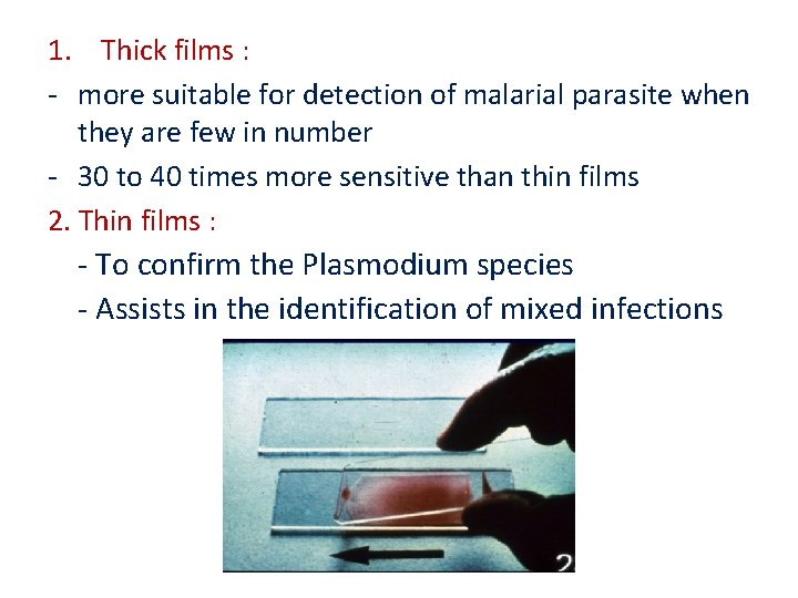 1. Thick films : - more suitable for detection of malarial parasite when they 1. Thick films : - more suitable for detection of malarial parasite when they