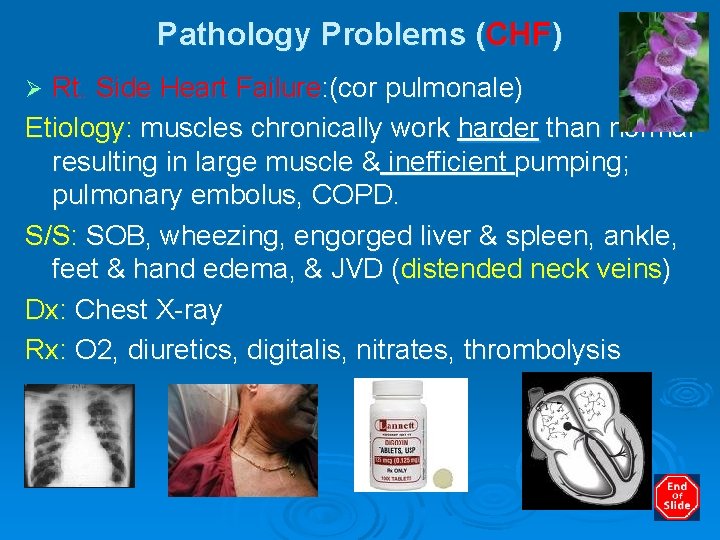 Pathology Problems (CHF) Rt. Side Heart Failure: (cor pulmonale) Etiology: muscles chronically work harder
