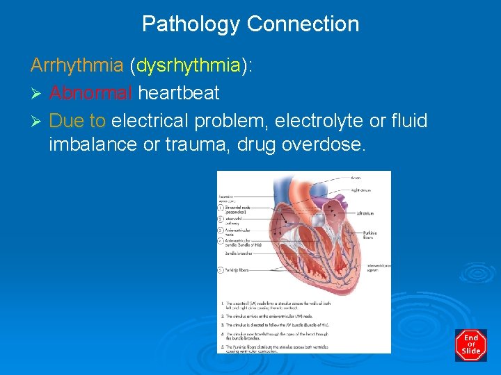 Pathology Connection Arrhythmia (dysrhythmia): Ø Abnormal heartbeat Ø Due to electrical problem, electrolyte or