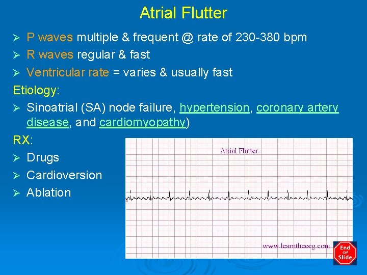 Atrial Flutter P waves multiple & frequent @ rate of 230 -380 bpm Ø