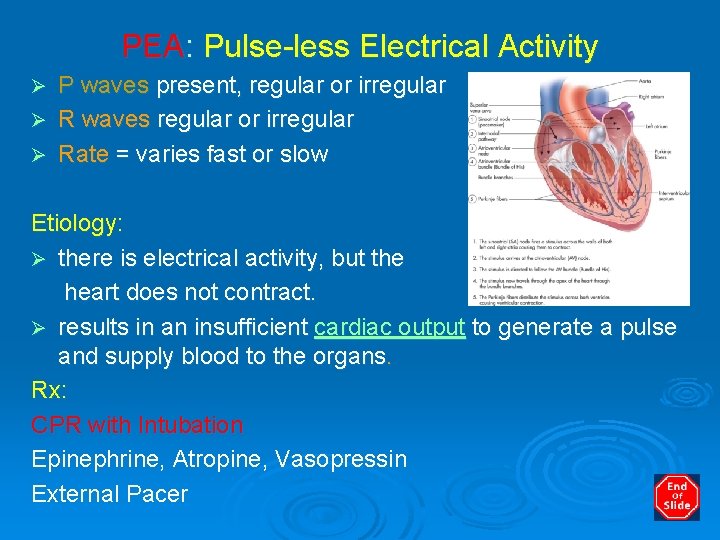 PEA: Pulse-less Electrical Activity P waves present, regular or irregular Ø R waves regular