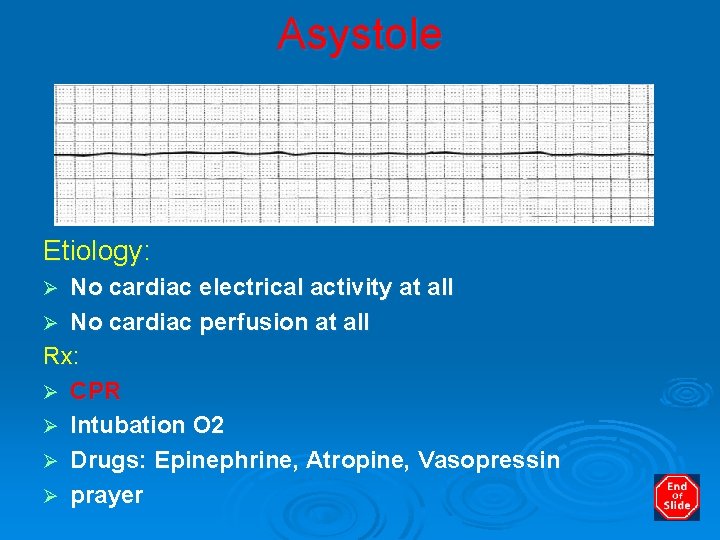 Asystole Etiology: No cardiac electrical activity at all Ø No cardiac perfusion at all
