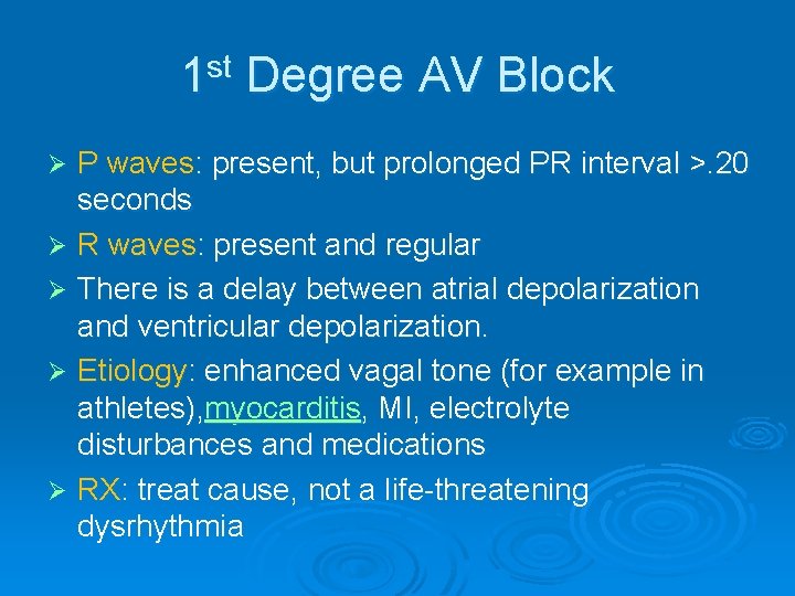 1 st Degree AV Block P waves: present, but prolonged PR interval >. 20