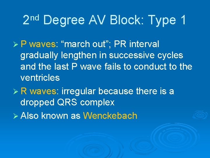 2 nd Degree AV Block: Type 1 Ø P waves: “march out”; PR interval