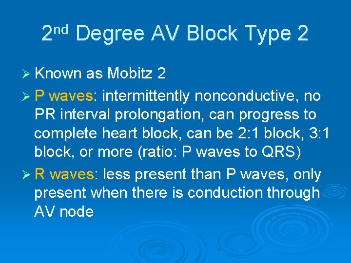 2 nd Degree AV Block Type 2 Ø Known as Mobitz 2 Ø P