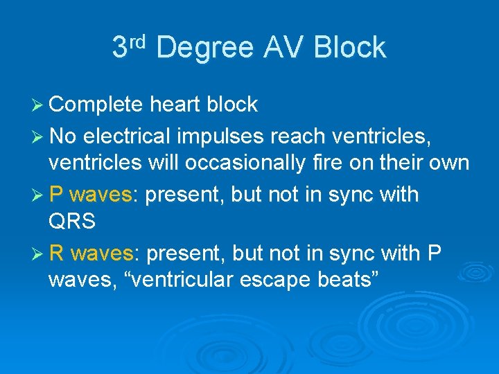 3 rd Degree AV Block Ø Complete heart block Ø No electrical impulses reach