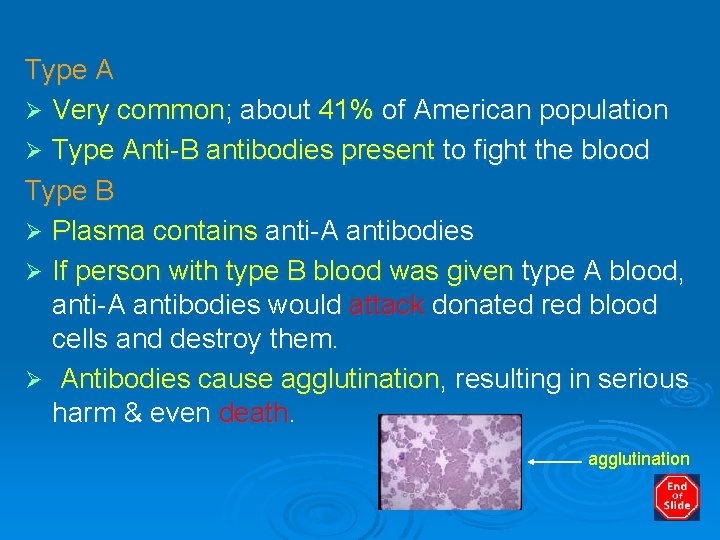 Type A Ø Very common; about 41% of American population Ø Type Anti-B antibodies