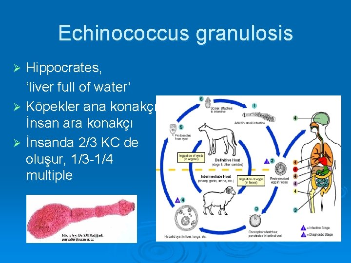 Echinococcus granulosis Hippocrates, ‘liver full of water’ Ø Köpekler ana konakçı İnsan ara konakçı