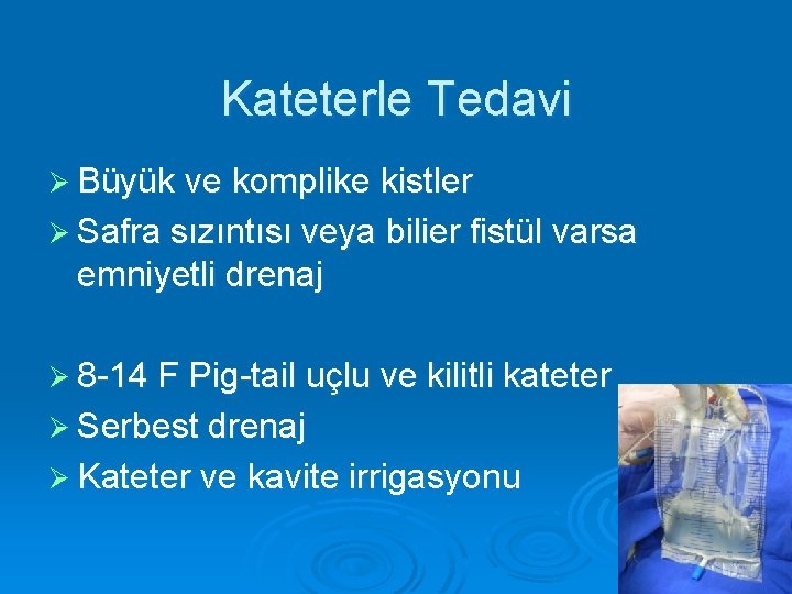 Kateterle Tedavi Ø Büyük ve komplike kistler Ø Safra sızıntısı veya bilier fistül varsa