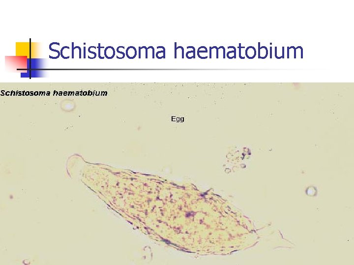 Schistosoma haematobium 