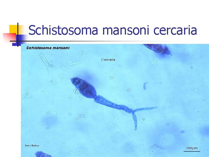 Schistosoma mansoni cercaria 