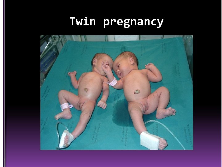 Twin pregnancy 