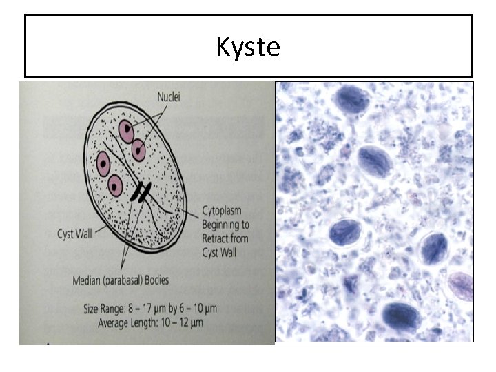 Kyste 