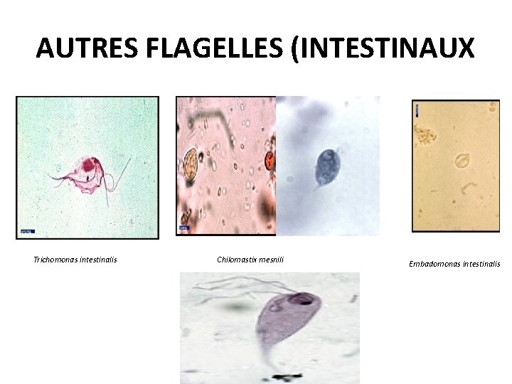 AUTRES FLAGELLES (INTESTINAUX Trichomonas intestinalis Chilomastix mesnili Embadomonas intestinalis 