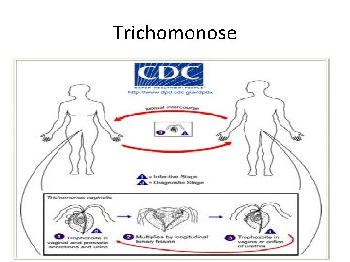 Trichomonose 