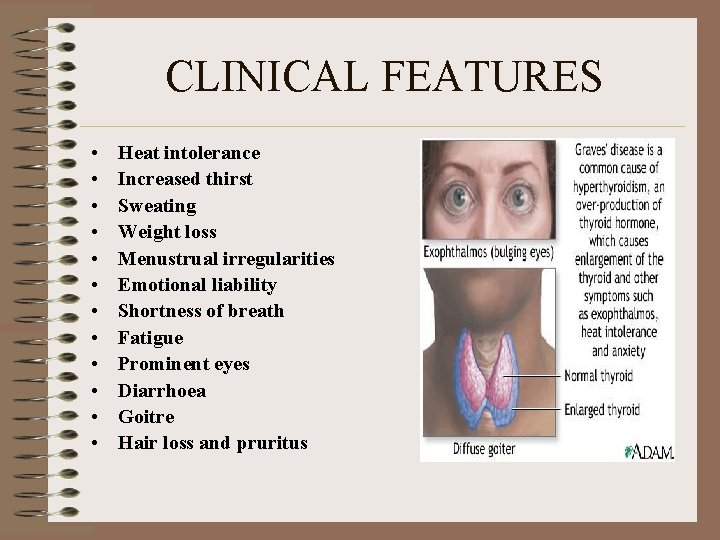 CLINICAL FEATURES • • • Heat intolerance Increased thirst Sweating Weight loss Menustrual irregularities