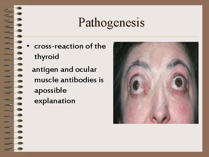 Pathogenesis • cross-reaction of the thyroid antigen and ocular muscle antibodies is apossible explanation
