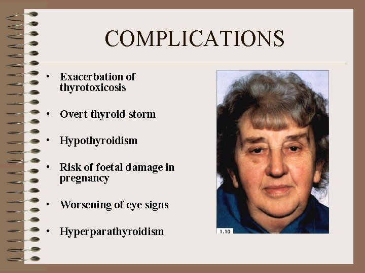 COMPLICATIONS • Exacerbation of thyrotoxicosis • Overt thyroid storm • Hypothyroidism • Risk of