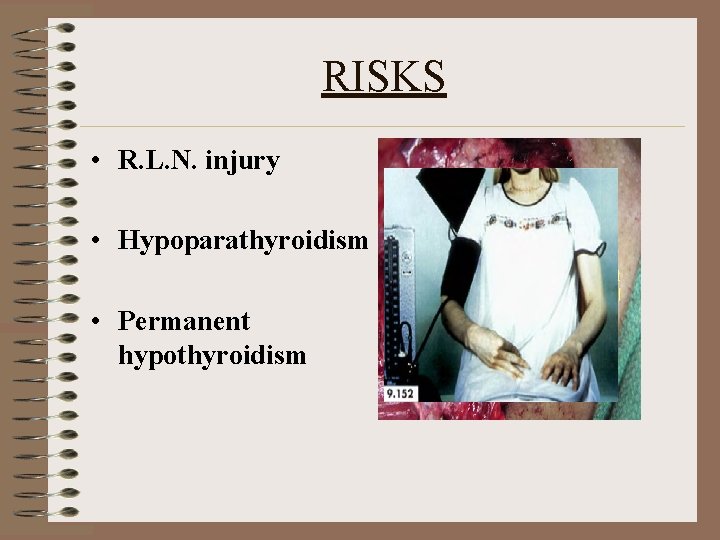 RISKS • R. L. N. injury • Hypoparathyroidism • Permanent hypothyroidism 