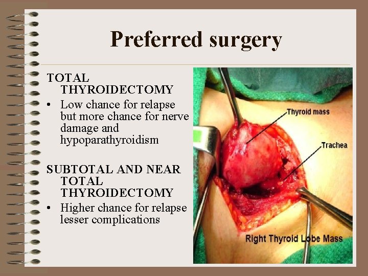 Preferred surgery TOTAL THYROIDECTOMY • Low chance for relapse but more chance for nerve