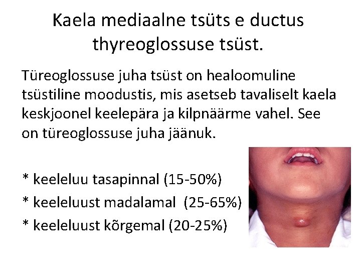 Kaela mediaalne tsüts e ductus thyreoglossuse tsüst. Türeoglossuse juha tsüst on healoomuline tsüstiline moodustis,