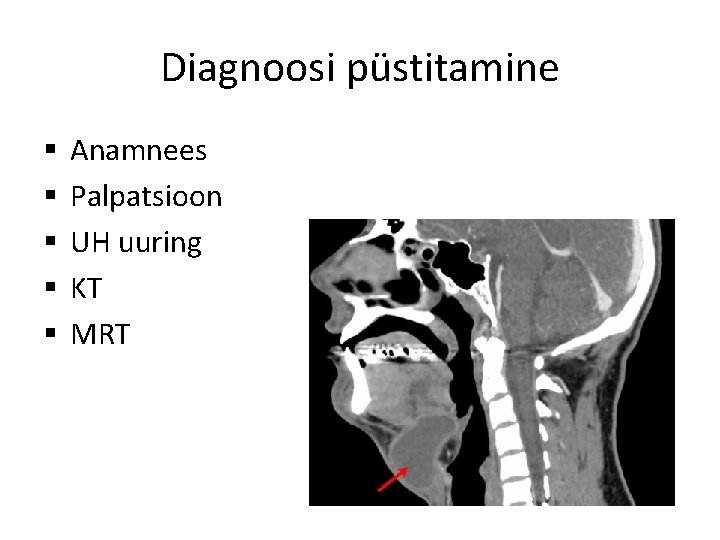 Diagnoosi püstitamine § § § Anamnees Palpatsioon UH uuring KT MRT 