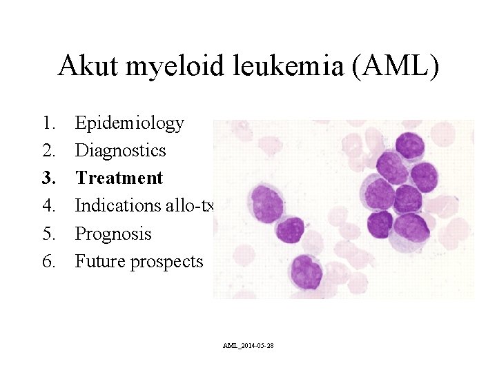 Akut myeloid leukemia (AML) 1. 2. 3. 4. 5. 6. Epidemiology Diagnostics Treatment Indications