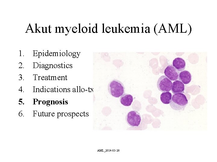 Akut myeloid leukemia (AML) 1. 2. 3. 4. 5. 6. Epidemiology Diagnostics Treatment Indications