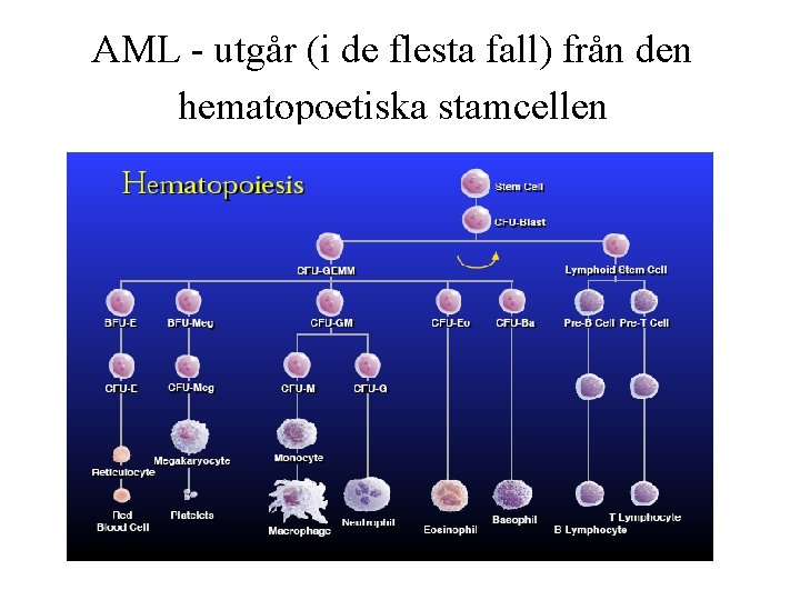 AML - utgår (i de flesta fall) från den hematopoetiska stamcellen AML_2014 -05 -28