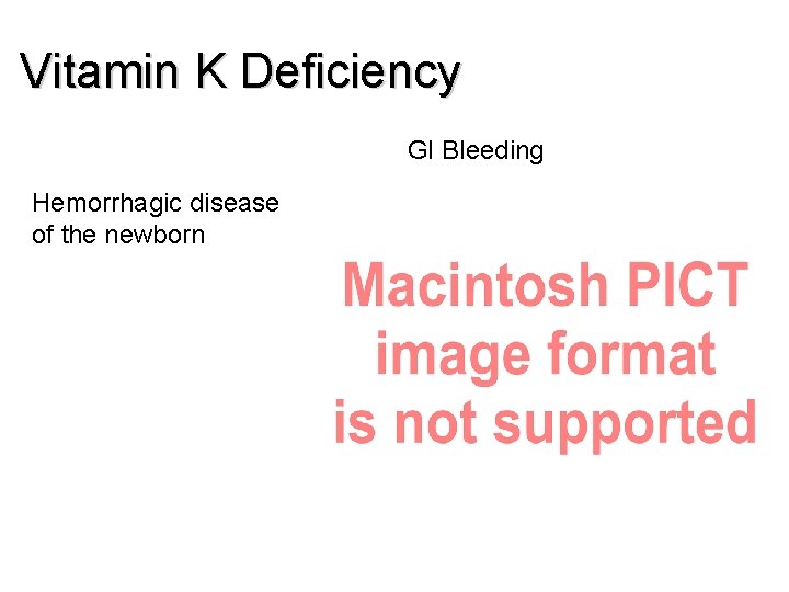Vitamin K Deficiency GI Bleeding Hemorrhagic disease of the newborn Vitamin K Deficiency GI Bleeding Hemorrhagic disease of the newborn